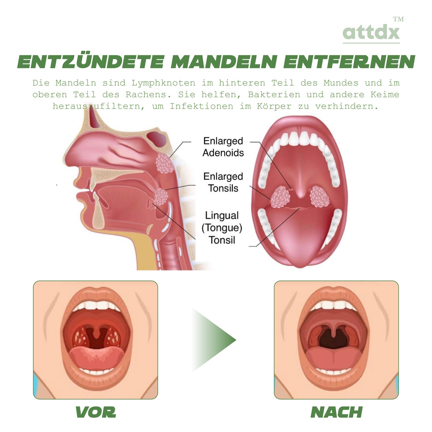 ATTDX Luftstromhilfe Bronchiale Erleichterung für die Kehle KräuterTropfen