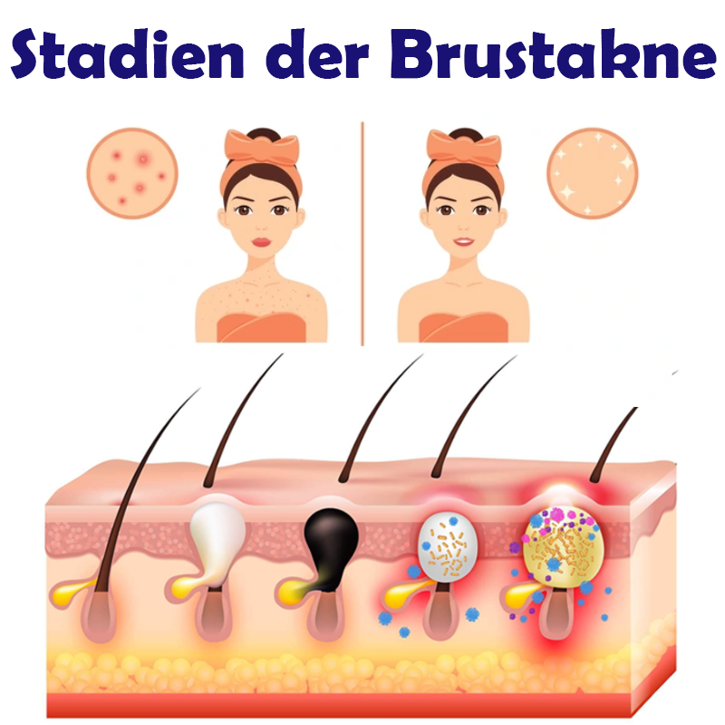 ATTDX BrustStraffende AufhellungsCreme