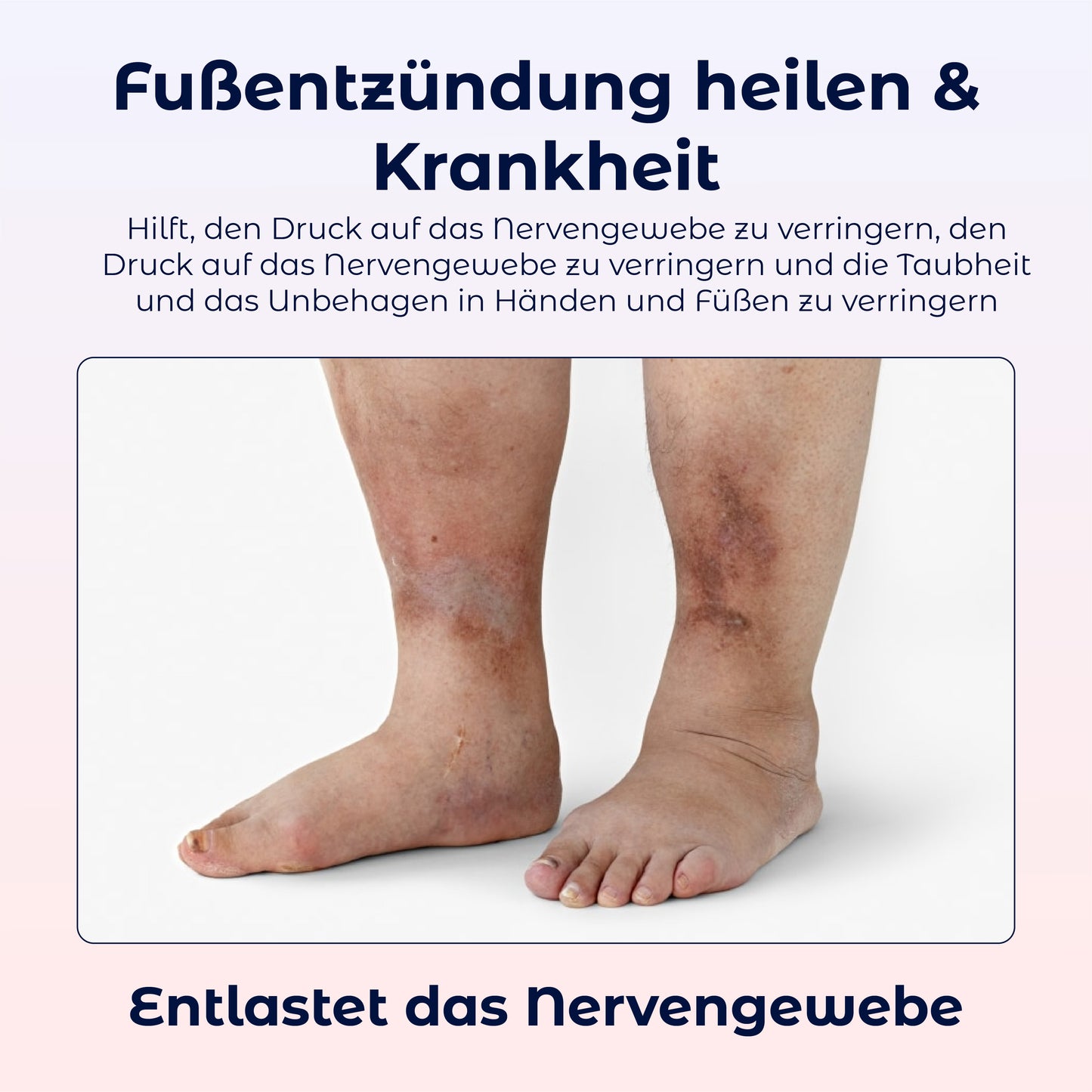 ATTDX Entzündungshemmendes Arthrose Spray