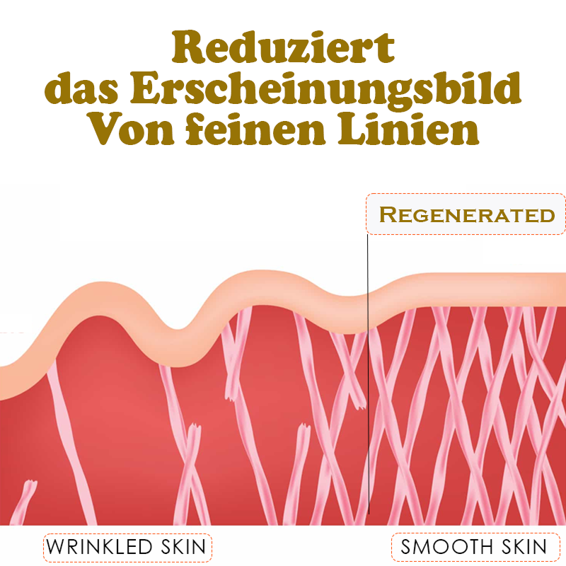 ATTDX Göttliche Lifting Protein Fäden