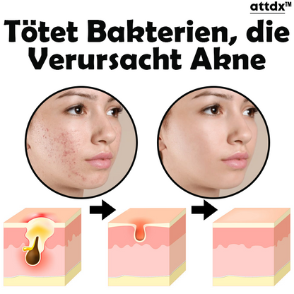 ATTDX Hautunreinheit Akne Jugend Serum