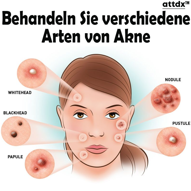 ATTDX Hautunreinheit Akne Jugend Serum