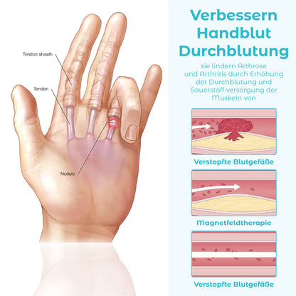 ATTDX MagnetErleichterung Handgelenkschutz Therapie Handschuhe