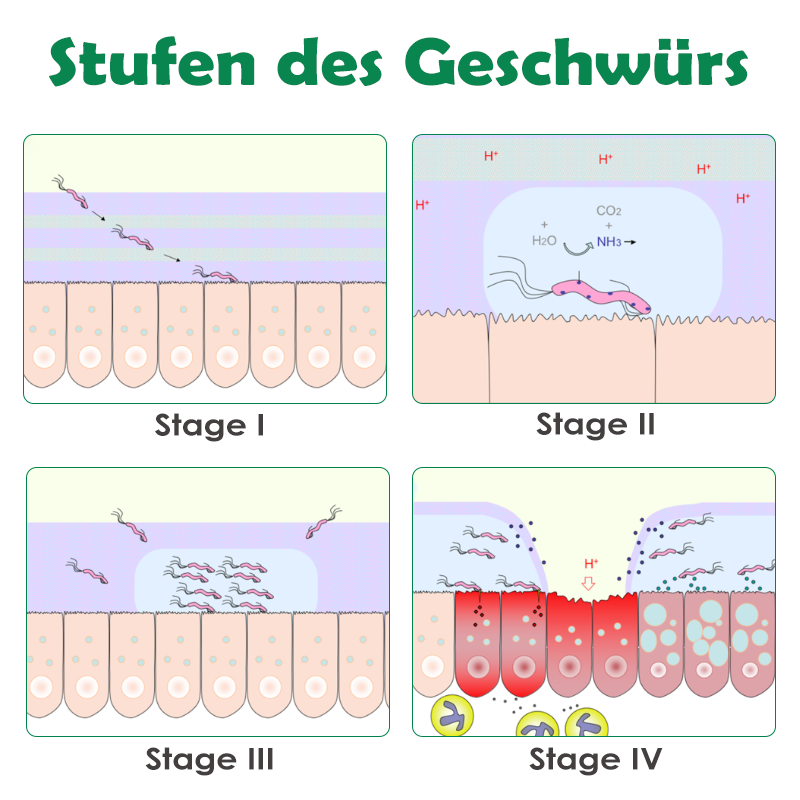 ATTDX Mundpflege Propolis GeschwürErleichterung Sprühen