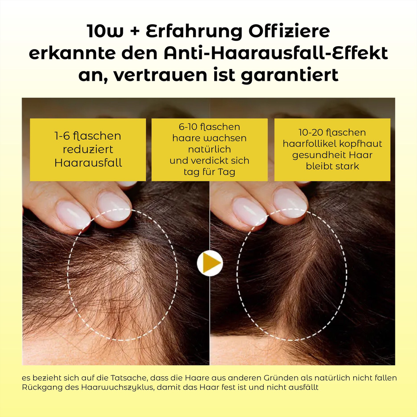 ATTDX Natürliches Haarwachstums Essential Öl