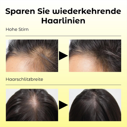 ATTDX Natürliches Haarwachstums Essential Öl