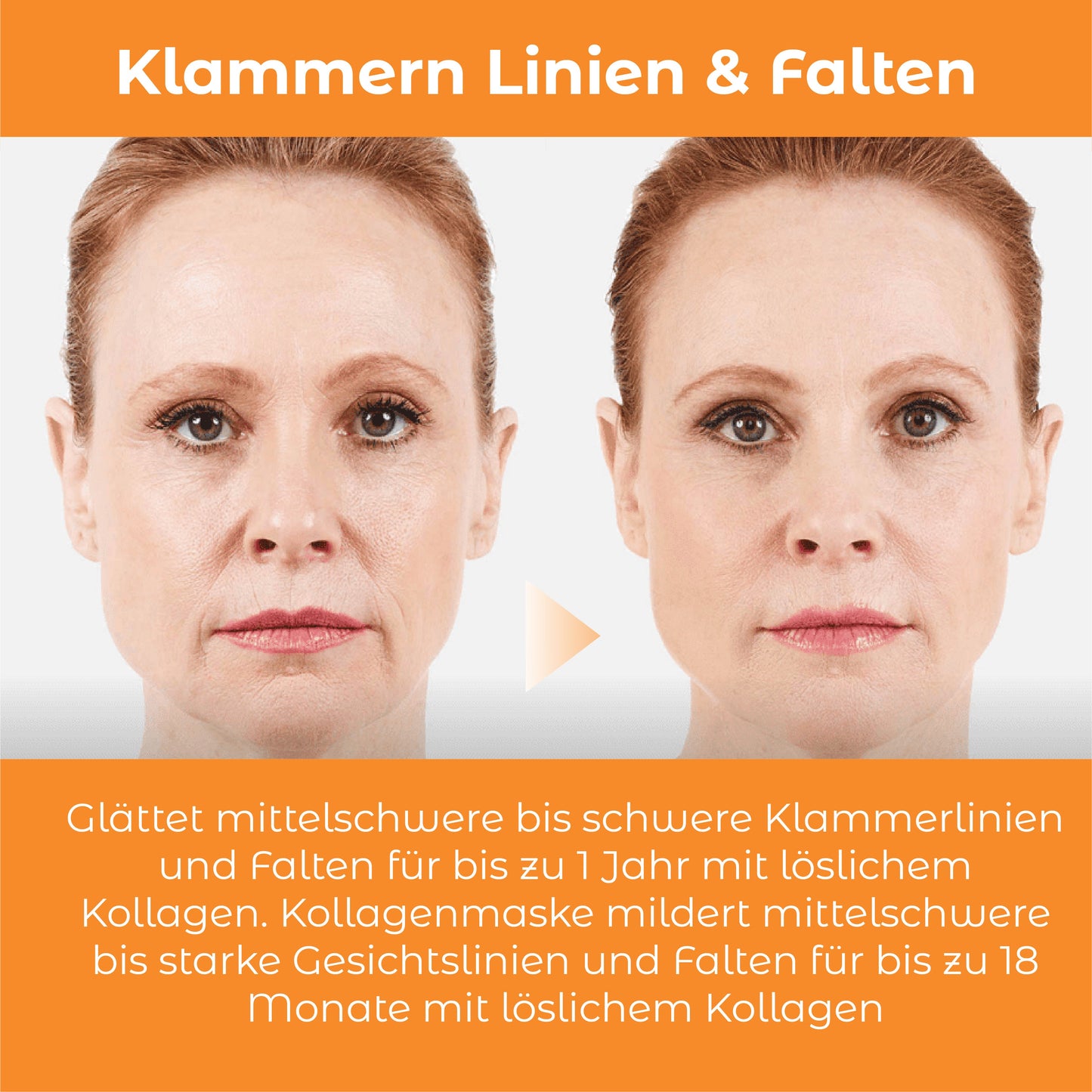 ATTDX Kollagen Löslich Antialterung Maske mit Spray