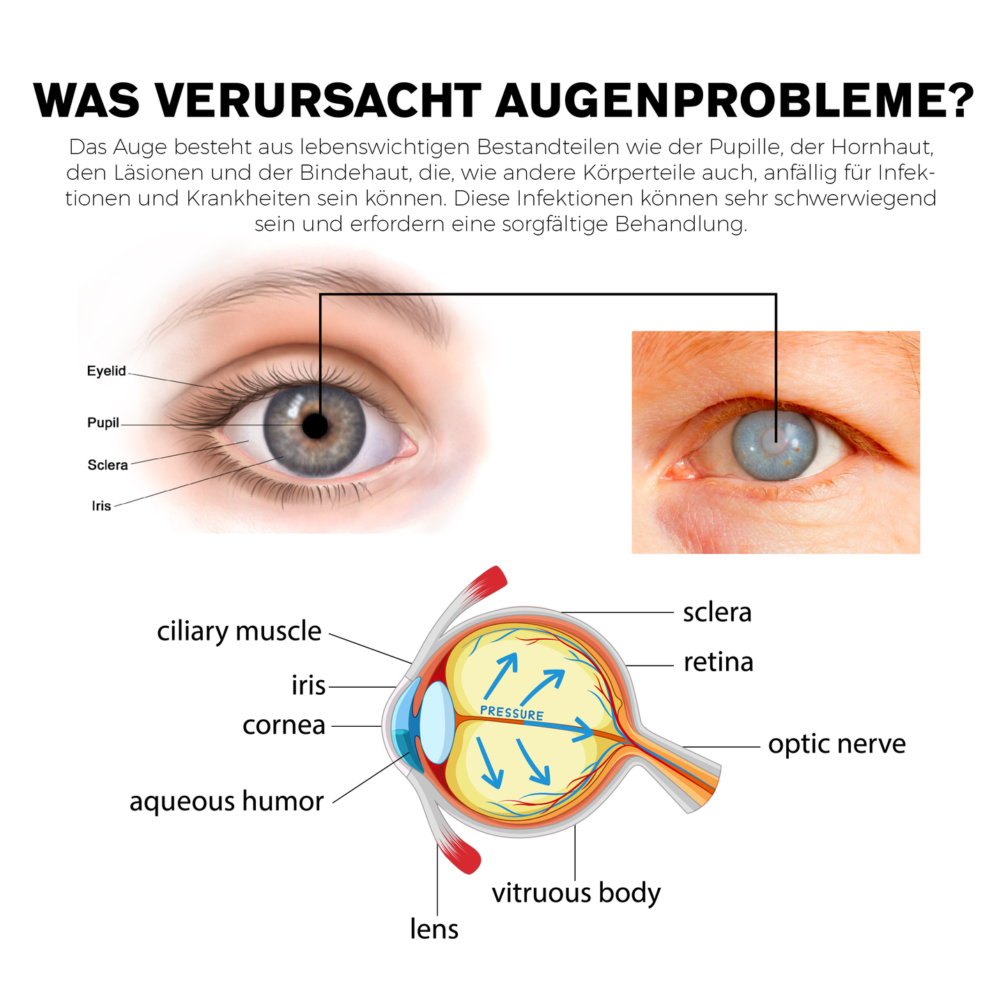 ATTDX Behandlung von Augenproblemen Umkehr Augentropfen