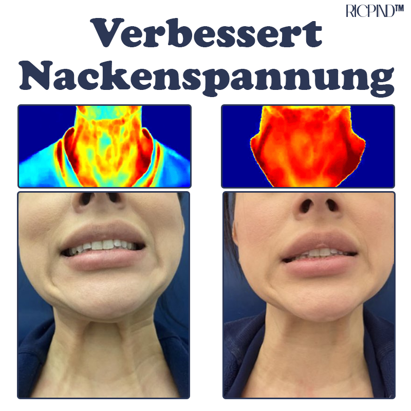 IONISCH Therapie Nacken Schmerzlinderung Pad