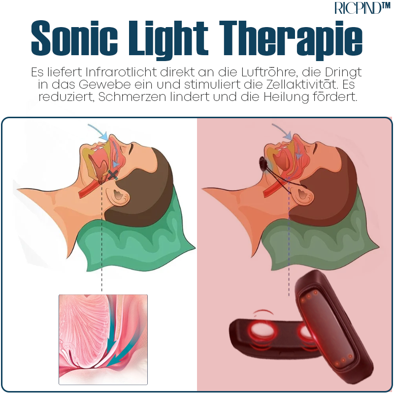 RICPIND Luftröhre Leichtigkeit SonicLight Therapie Beruhigend Instrument