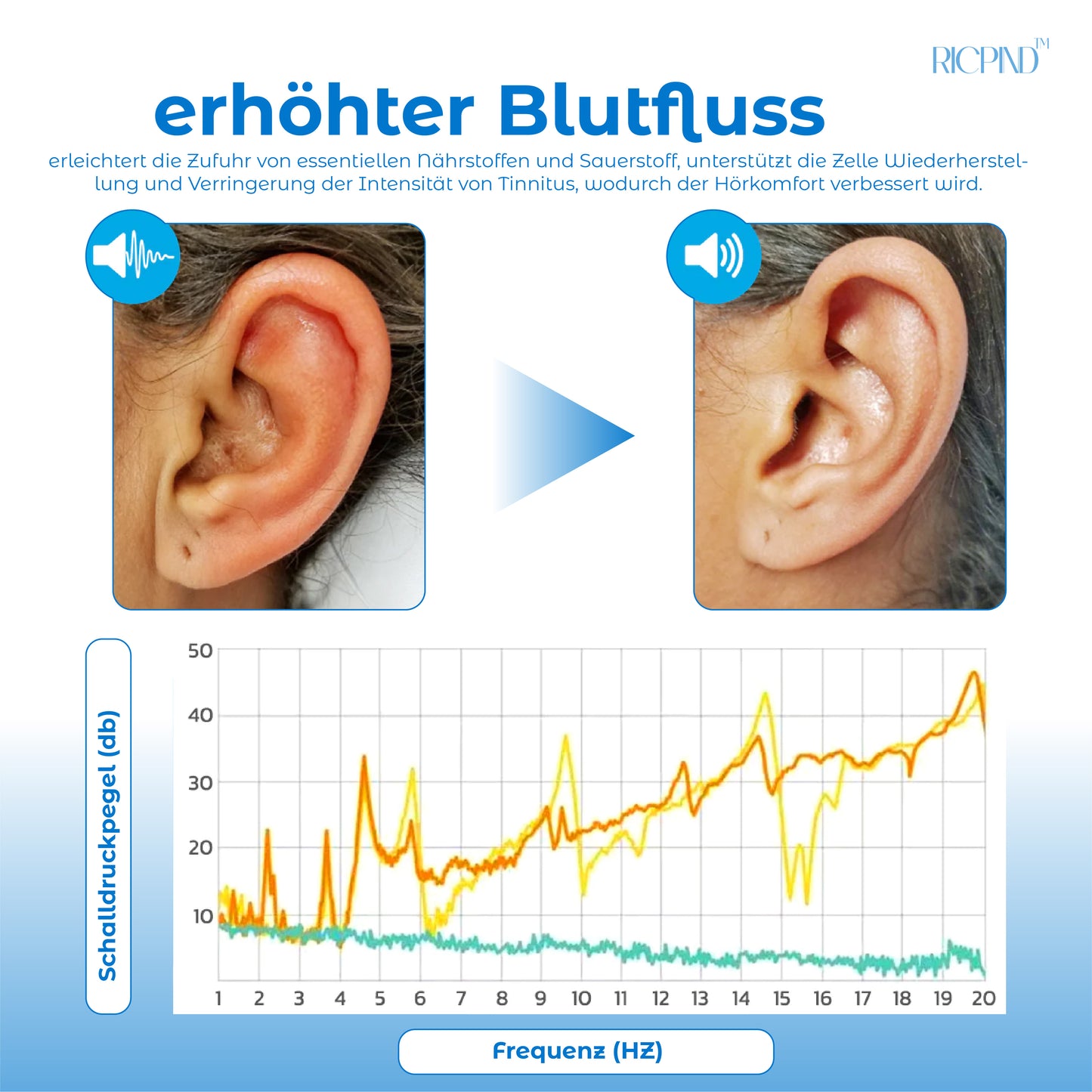 RICPIND Tinnitus Nervbehandeln InfrarotWärmestift