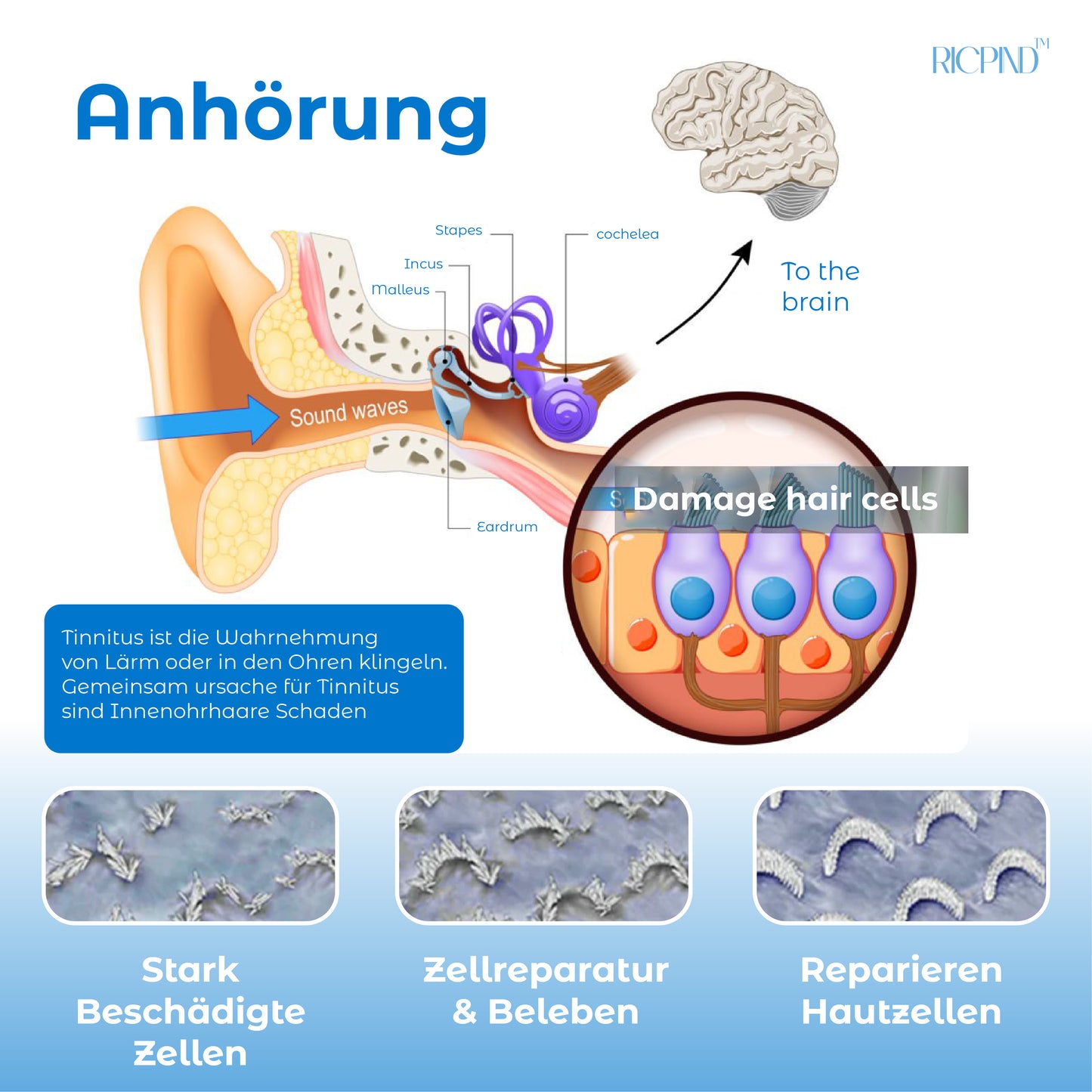 RICPIND Tinnitus Nervbehandeln InfrarotWärmestift