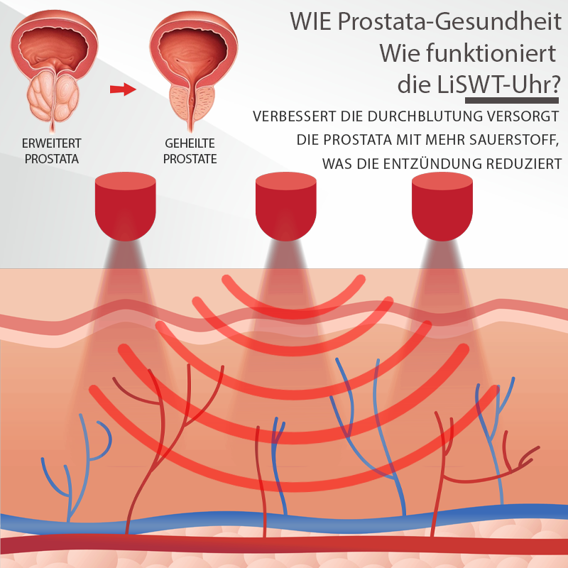 RICPIND™ Prostata Gesundheit LiSWT Uhr