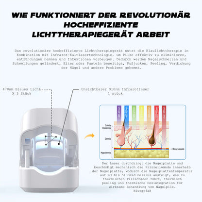 Ricpind Nagelpilz ReinigungLaser TherapeutischesGerät