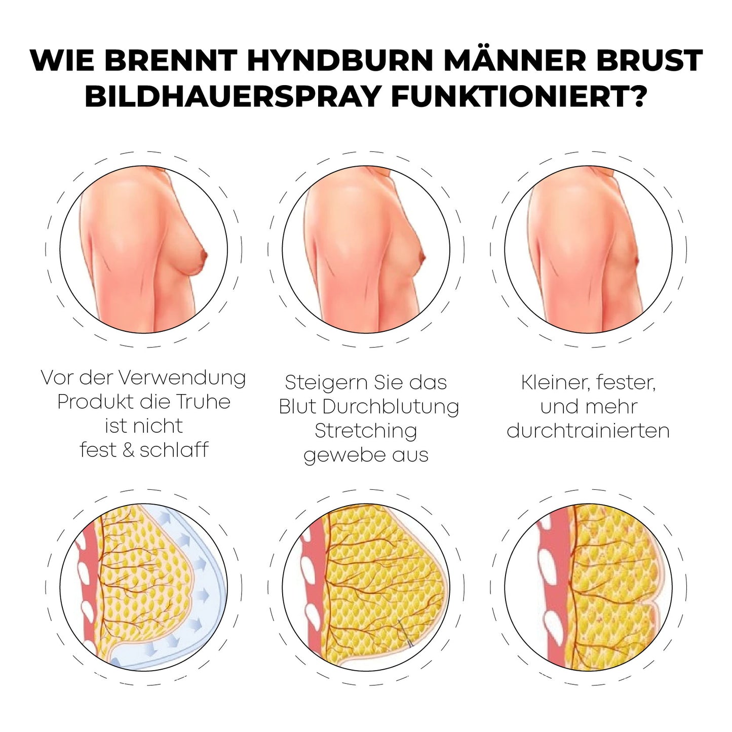 RICPIND FormMax Gynäkomastie Kompression Reißverschluss Weste