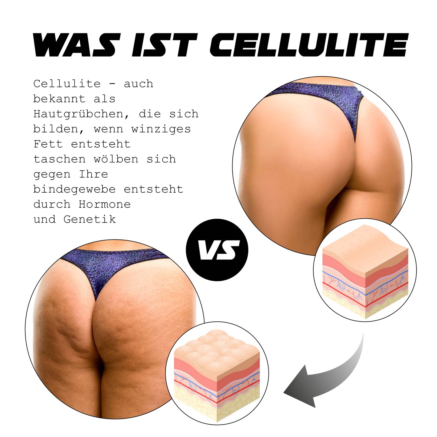 ATTDX CelluBrennen HautAnziehen Creme