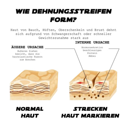 ATTDX CelluBrennen HautAnziehen Creme