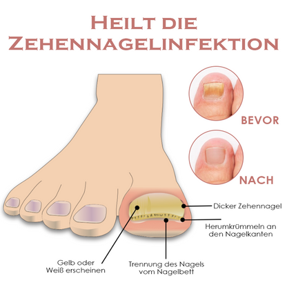 ATTDX Fußheilung ÄtherischesÖl BadeTabletten