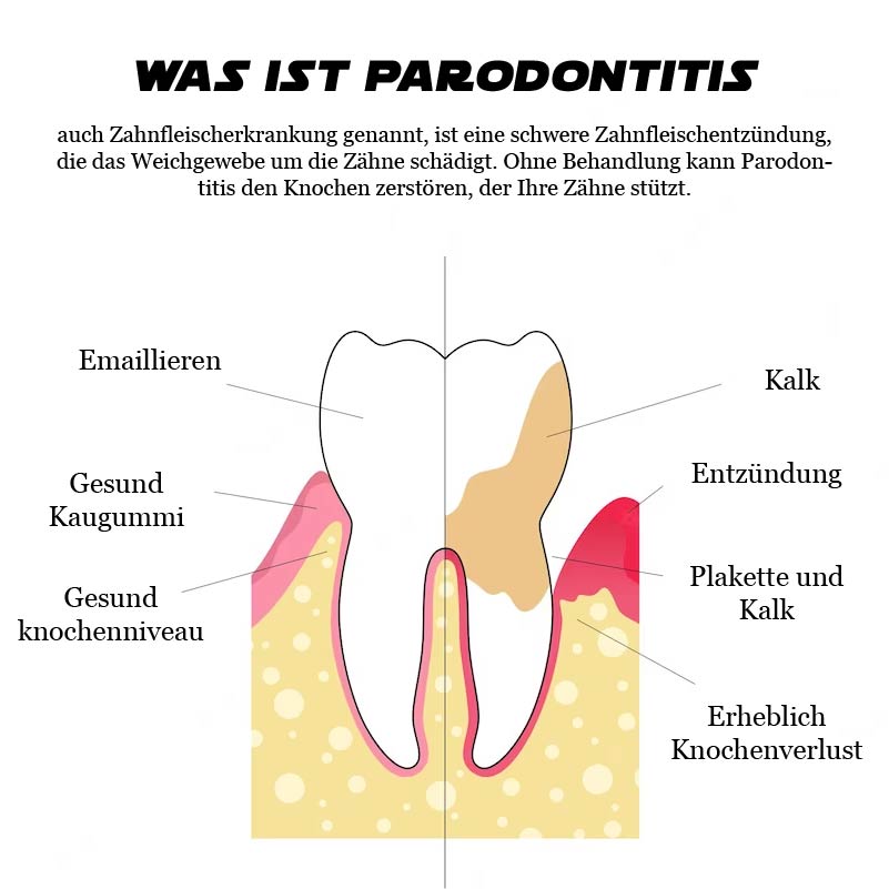 ATTDX GumErleichterung ParodontalBehandlung Gel