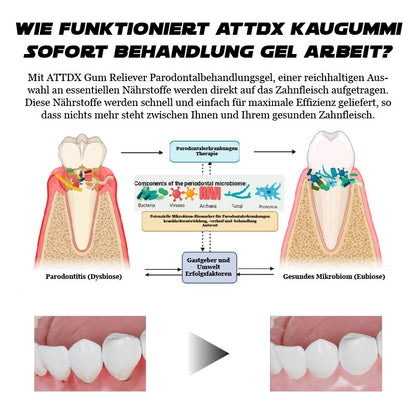 ATTDX GumErleichterung ParodontalBehandlung Gel