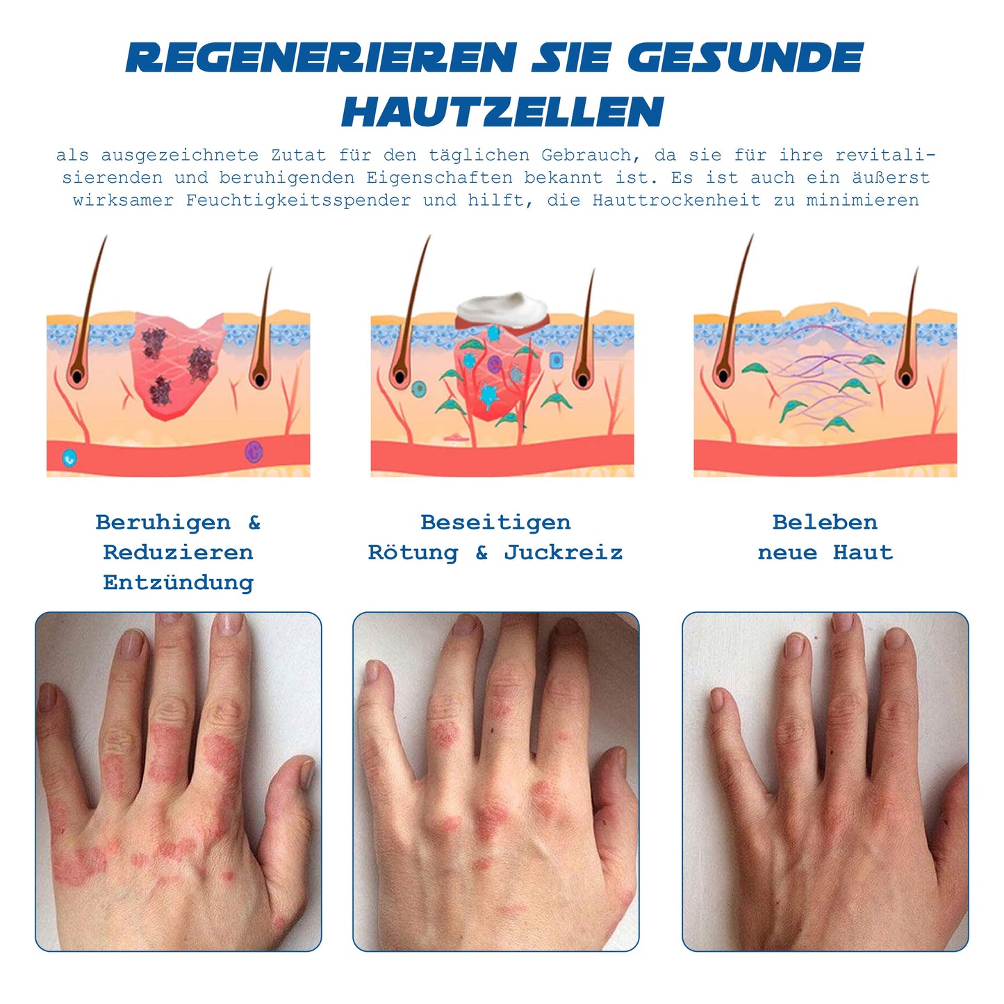 ATTDX Psoriasis Behandlung BieneVenom Creme