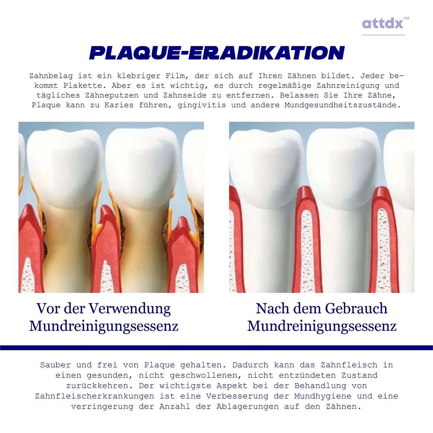 ATTDX ZähneAufhellung OralReinigung Essenz