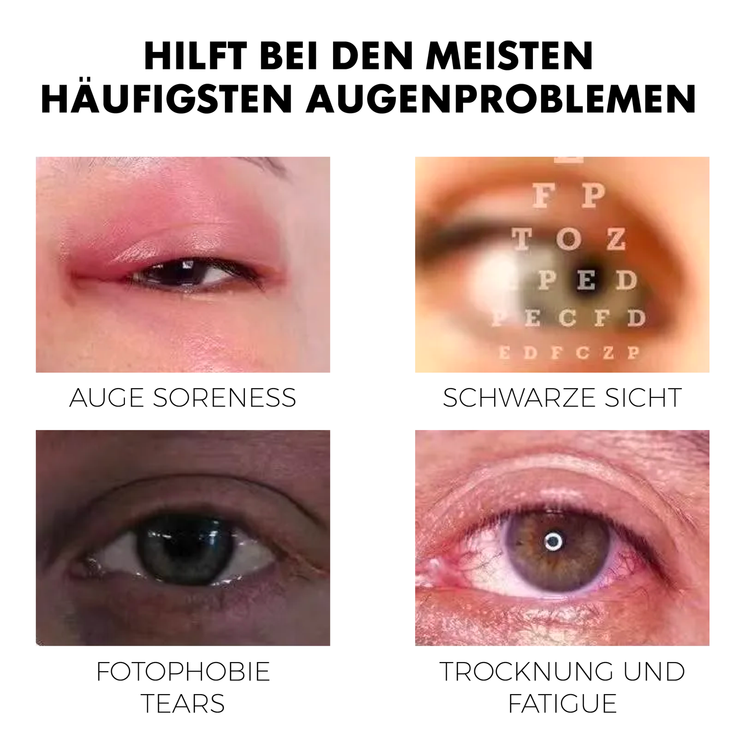 ATTDX Behandlung AugenProbleme LösungsTropfen