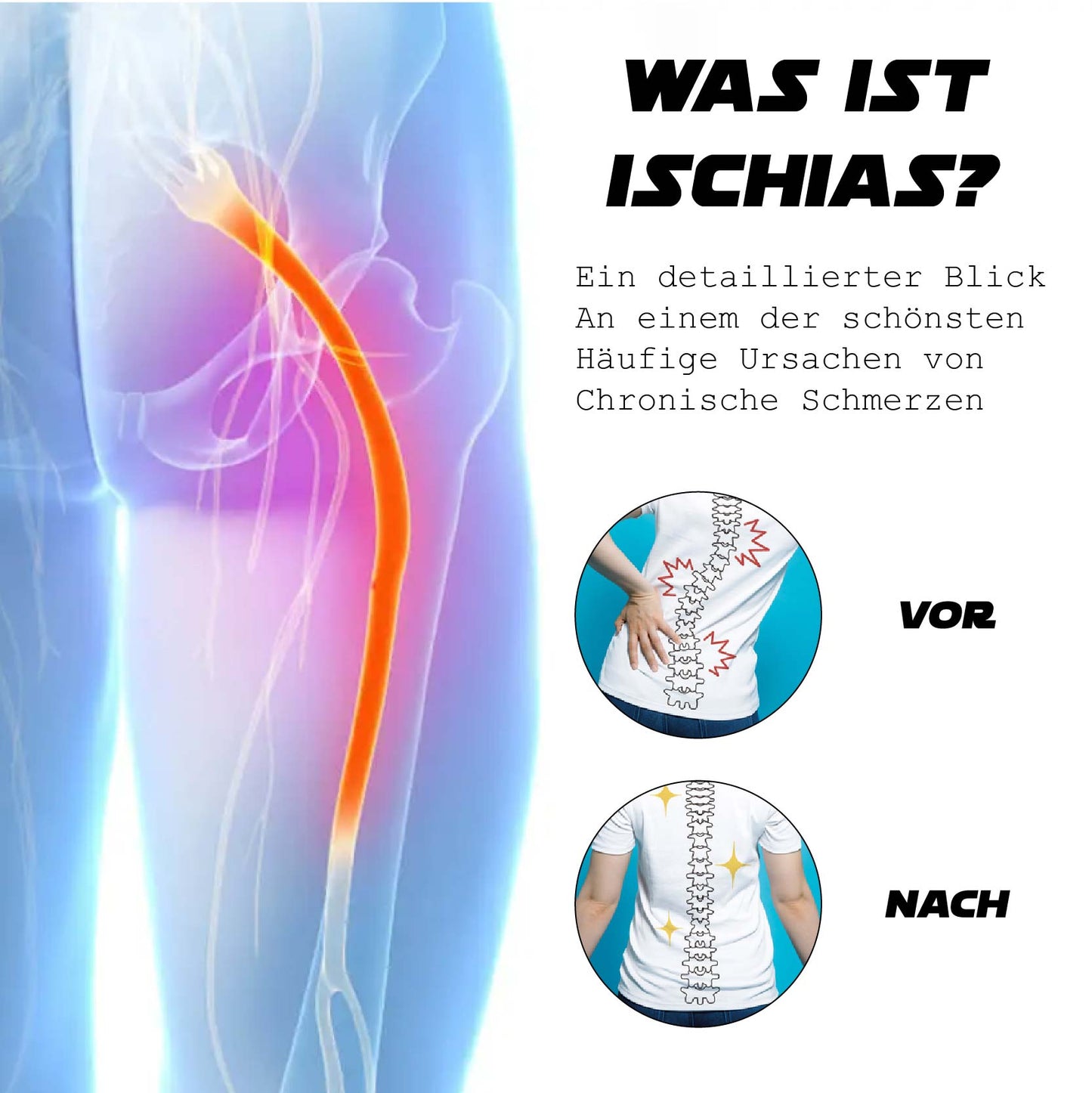 Ricpind EMS IschiasReliever Therapeutisch Massagegerät