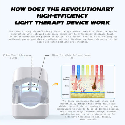 Ricpind NailFungal CleaningLaser TherapeuticDevice