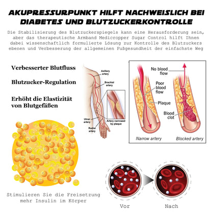 Ricpind ErleichterungZuckerkrankheit KörperBildhauerei HandRiemen