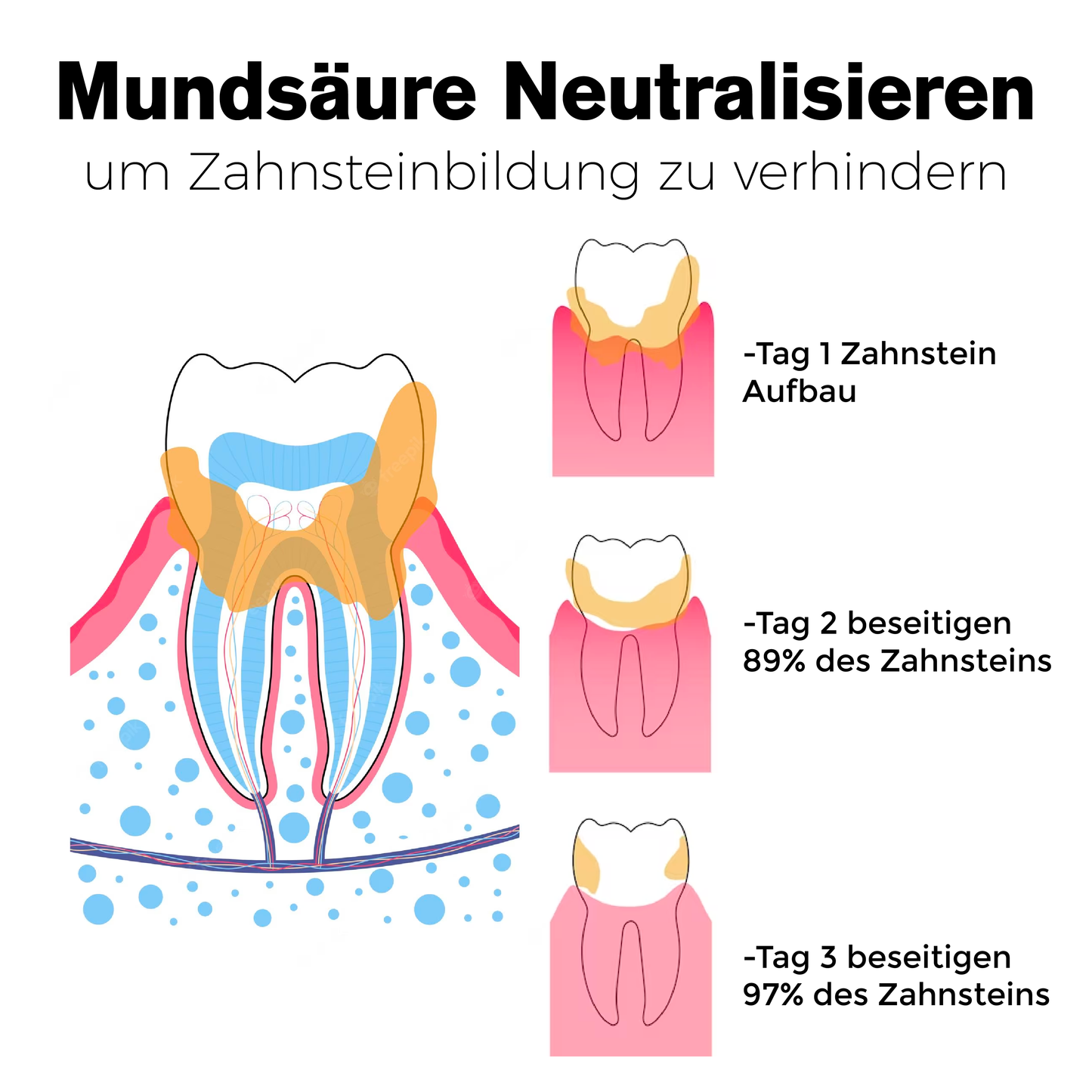 ATTDX ZähneReparieren Fleckenentferner Ampulle